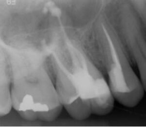 radiografias finales del caso noe hernandez 1