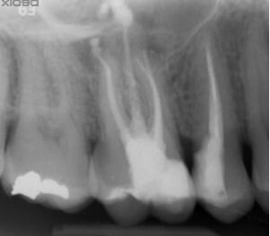 radiografias finales del caso noe hernandez 2